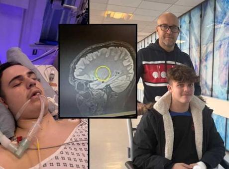 SON DAKİKA HABERLER: Doktorlar 1 yıldır 'basit bir baş ağrısı' diyordu! Acı gerçek sonradan ortaya çıktı: Tedavisi yok