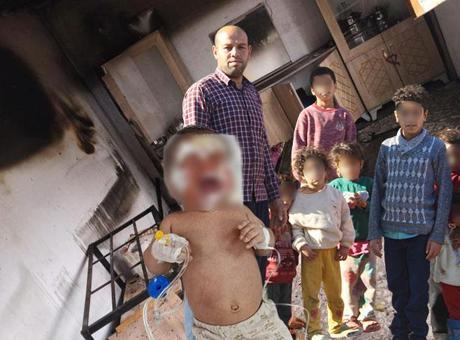 14 kişilik ailenin evinde esrarengiz yangınlar! 2 aylık bebekleri yanarak yaralandı: 'Hepimiz aynı odada kalıyoruz'