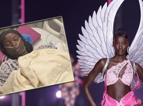 Victoria's Secret modelinin sağlık mücadelesi! 'Akciğerlerimi yok ediyor'