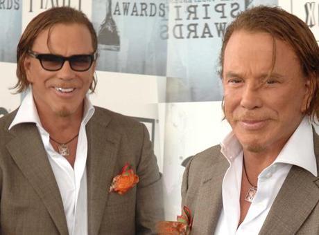 Bir dönemin efsanesiydi! Mickey Rourke artık tanınmaz halde