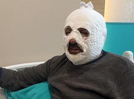 Arkadaşına 'iyilik' yapmak istedi 'ibretlik' oldu: Ben yandım kimse yanmasın