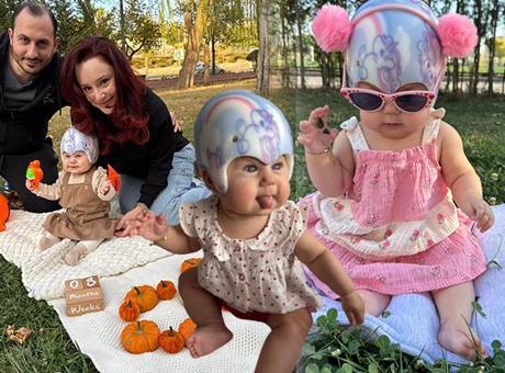 Doğumda öğrendikleri teşhis hayatlarını değiştirdi! ‘Doktorun ağzından duymak dünyamı yıktı’