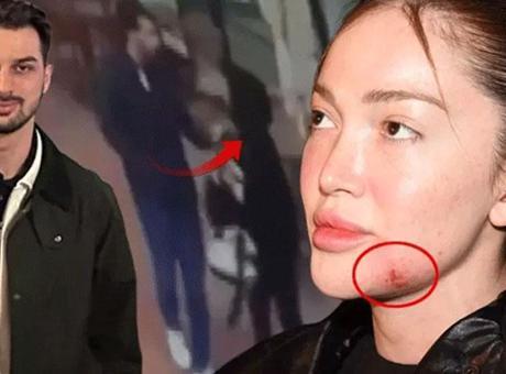 Haberler: Danla Biliç’i darbeden eski sevgilinin cezası ne oldu?