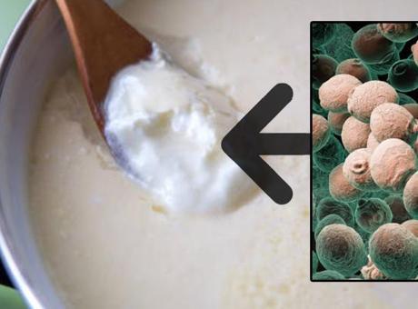 Yoğurt mayası tutmadıysa hemen deneyin! 2 saatte düzeliyor: Sünmesinin nedeniymiş