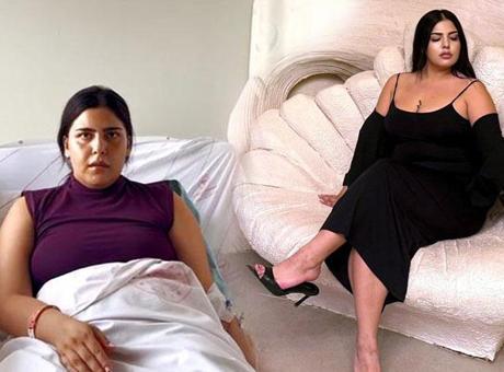 Lazer epilasyon faciası! Ateşlendi, ameliyat oldu: 20 gün hastanede yattım