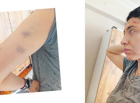 Bir ay önce evlendi ölümden döndü