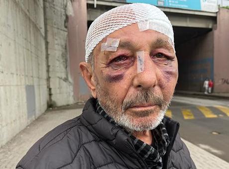 Yoldan geçerken durup dövdüler: Bu mahallede her şey var, şu anda Dallas gibi!