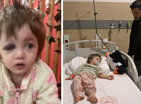 Yalova'da 14 aylık kızı ile birlikte darbedilen babadan yeni açıklama