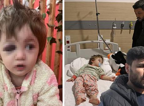 Yalova’da 14 aylık bebeği hastanelik ettiler! İddiaların odağındaki komşu konuştu