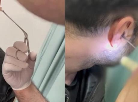 Şüpheli hareketleri dikkat çekmişti! Kulağından çıkanlar şoke etti