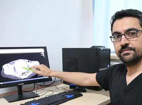 Doktorlar bile bunu beklemiyordu! Ameliyatı aldılar: Görünce şok olduk