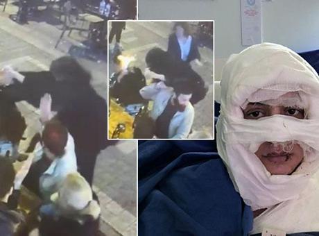 Kadıköy'de genç kadını kolonya döküp yakan Sibel Arya Geriş nedenini anlattı