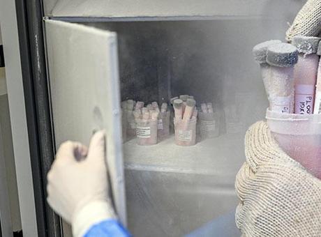 Türkiye'de bir ilk! 5 yıl saklanıyor: Ölenlerin sırt ve bacaklarından alınıyor: Belli olmuyor bile, o kadar çok hayat kurtarıyor