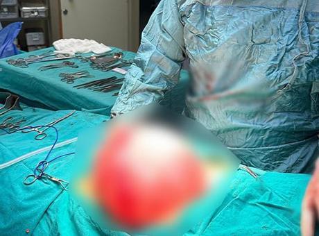 Kilo vermek için hastaneye gitti! 14 yaşındaki çocuğun karnından çıkan şaşkına çevirdi