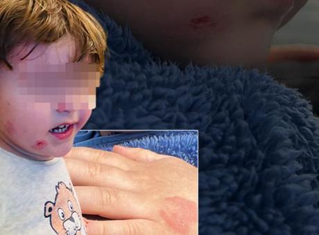 Özel kreşte skandal olay! 2,5 yaşındaki çocuk darp edildi