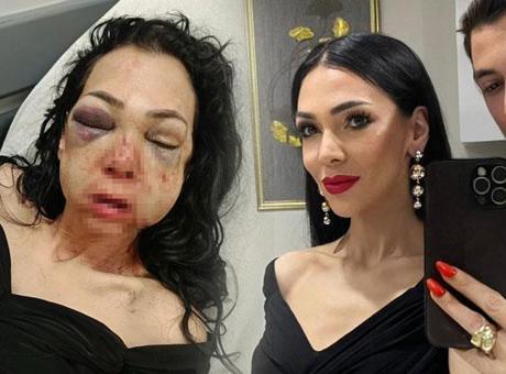 Hayatı bir günde değişti! Kocaeli'de dehşeti yaşayan kadın konuştu: Asla eskisi gibi olamayacağım