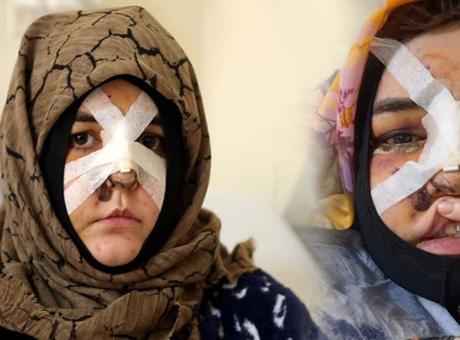 Kaldırım taşıyla dehşet! Mahkemeden kritik karar: Boş arazideki taşlara çarpmıştır