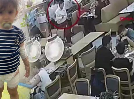 Kızgın tereyağı dolu tavanın sapı koptu, 2 yaşındaki Mercan 
