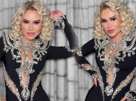 Estetik itirafıyla şaşırtmıştı! Ceylan'ın son halini görenler tanımakta güçlük çekti
