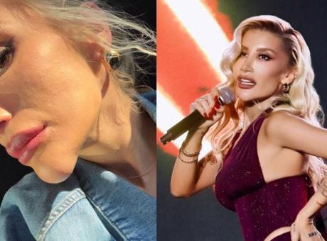 İrem Derici'nin çenesi olay oldu! Herkes dolgu sandı, gerçek bambaşka çıktı