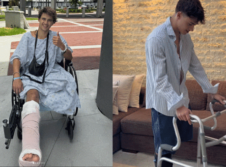 Bir bacağı ampute edilmişti! Survivor yarışmacısı yeni ve zorlu hayatına alışmaya çalışıyor