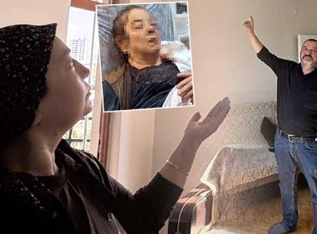 Televizyon izliyordu, gözünü kaybetti: Bunu yapan insan nasıl yapmış?