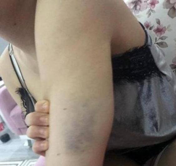 Son dakika haberi: Annemin sevgilisi taciz etti diyen Gizem Avcıdan şok açıklamalar