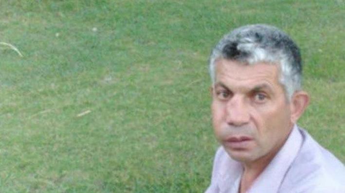 Dişini çektirdi, yüzünü kaybetti