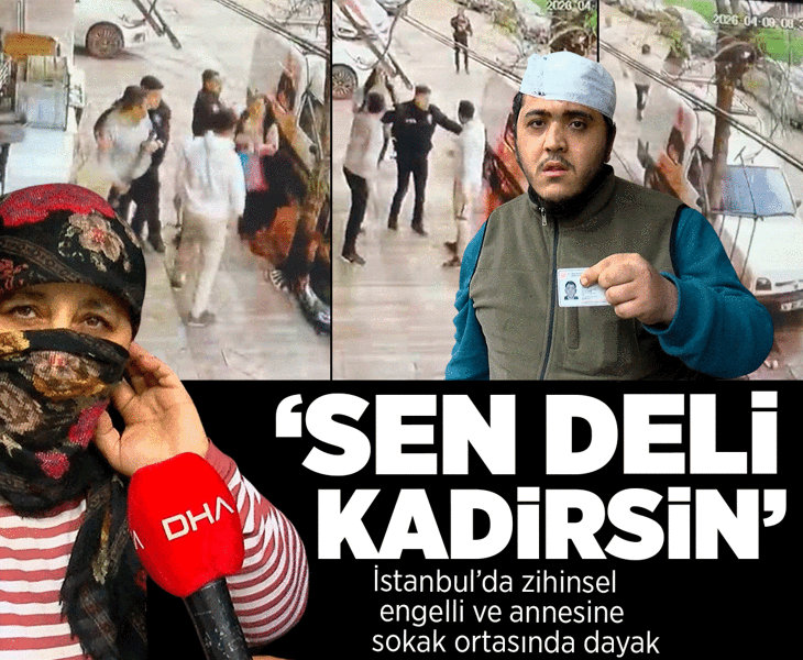 Zihinsel engelli ve annesine sopalı saldırı! 'Sen deli Kadirsin diyorlar'