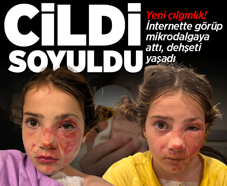 Yeni çılgınlık... İnternette görüp mikrodalgaya attı, dehşeti yaşadı! ‘Sanki cildim eriyordu’