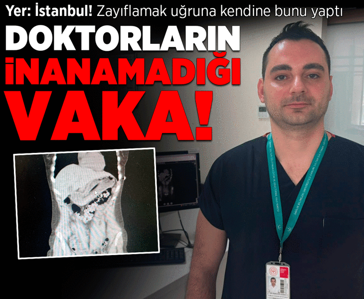 Zayıflamak uğruna kendine bunu yaptı! İstanbul'da doktorların inanamadığı vaka