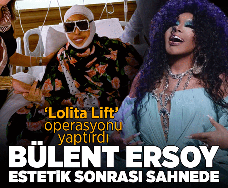 'Lolita Lift' operasyonu yaptırmıştı! Bülent Ersoy estetik sonrası sahnede: ‘Doktoruma kendimi emanet ettim’