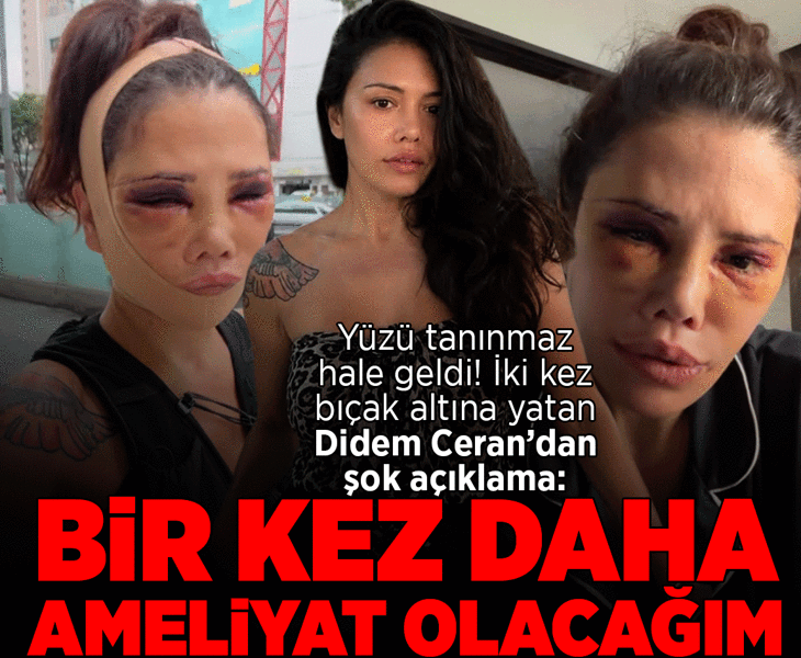 Yüz naklinin ardından revizyon ameliyatı olmuştu! Didem Ceran gözyaşlarına boğuldu
