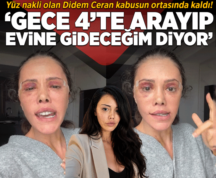 Yüz nakli olan Didem Ceran tehdit edildiğini söyledi: Gece beni arayıp 'evine gideceğim' diyor