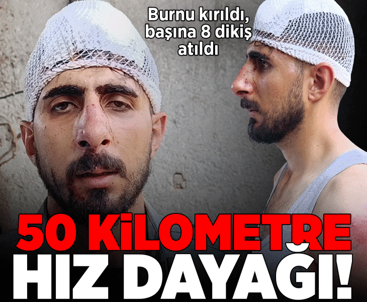 50 kilometre hız dayağı! Burnu kırıldı, başına 8 dikiş atıldı