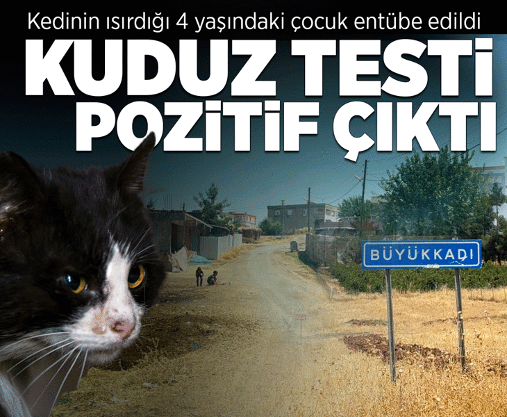 Kedinin ısırdığı 4 yaşındaki çocuk entübe edildi! Kuduz testi pozitif çıktı