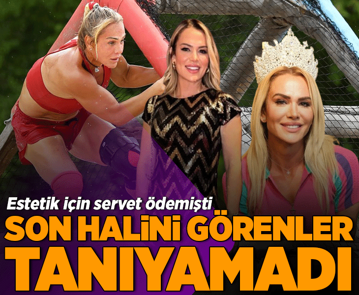 Değişimi için servet ödemişti! Estetik sonrası Survivor Nagihan Karadere'nin yeni hali dikkat çekti