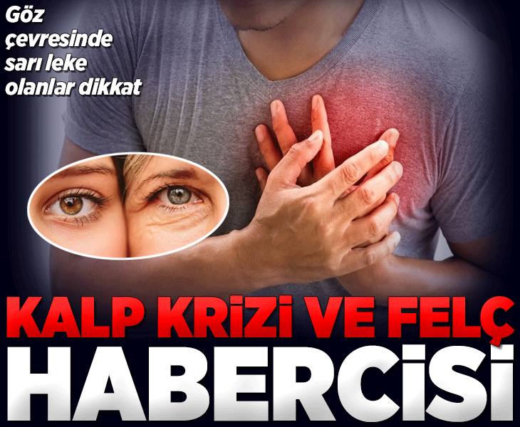 Uzmanlar uyarıyor! Göz çevresindeki sarı lekeler kalp krizi habercisi