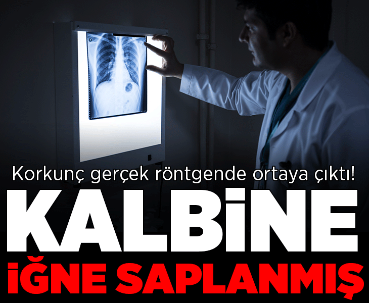 Korkunç gerçek röntgende ortaya çıktı! 'Kalbine iğne saplanmış'