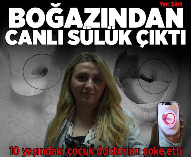 Doktor muayenede fark etti! 10 yaşındaki çocuğun boğazından canlı sülük çıktı