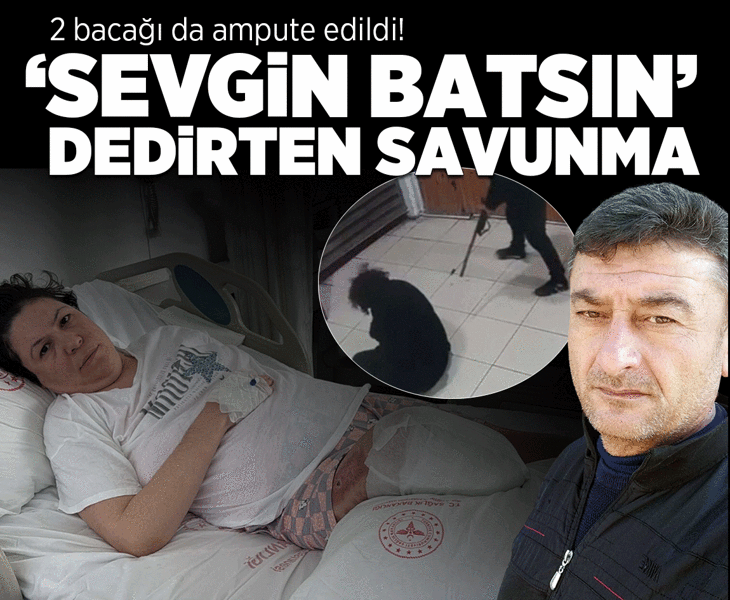2 bacağı da ampute edildi! 'Sevgin batsın' dedirten savunma
