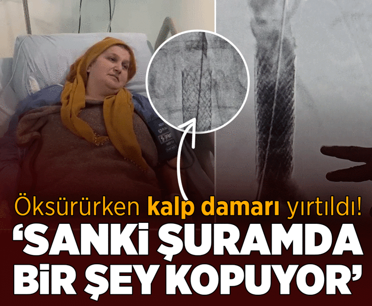 Milyonda bir görülen vaka! Öksürürken kalp damarı yırtılan kadın ölümden döndü