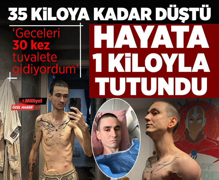 35 kiloya kadar düştü, 1 kiloyla hayata tutundu! 'Geceleri 30 kez tuvalete gidiyordum'