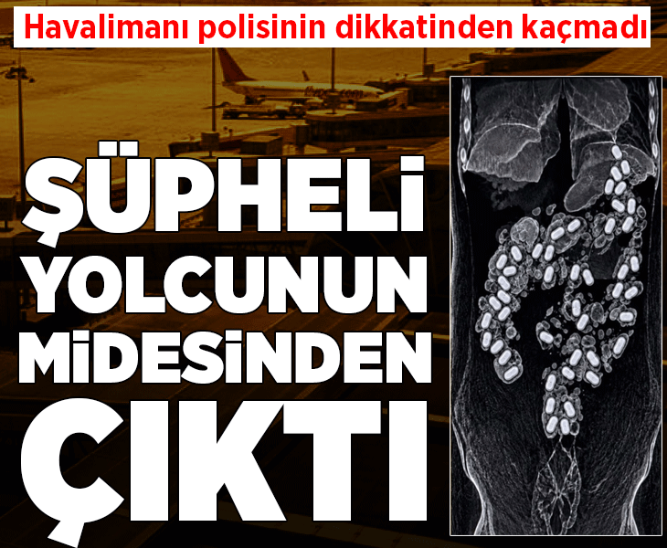 Havalimanı polisinin dikkatinden kaçamadı! Şüpheli yolcunun midesinden çıkanlar şoke etti