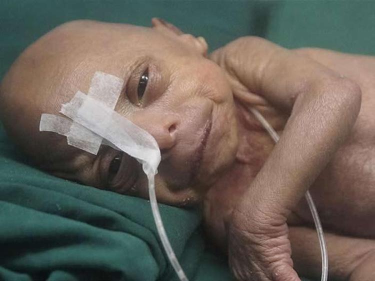 1. 100 yaşında doğan bebek