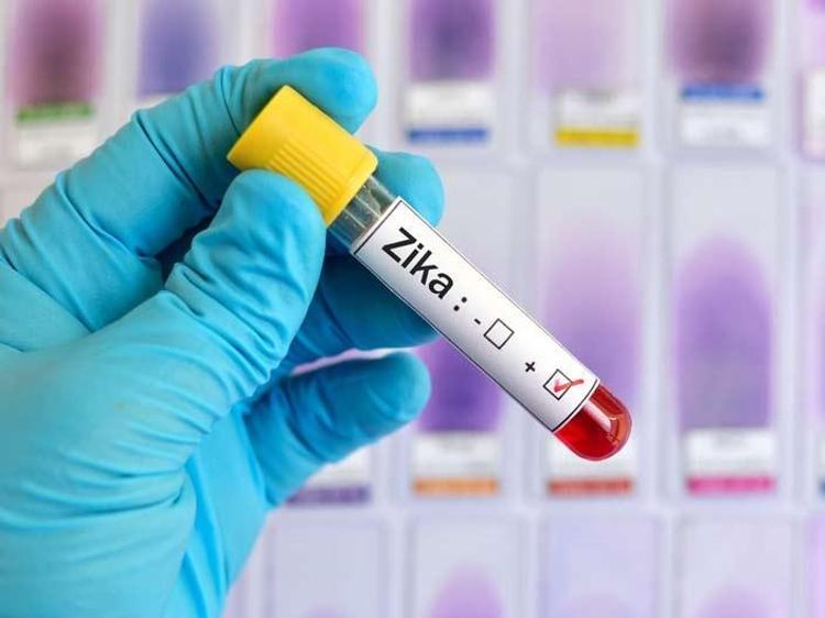 5. Zika Virüsü
