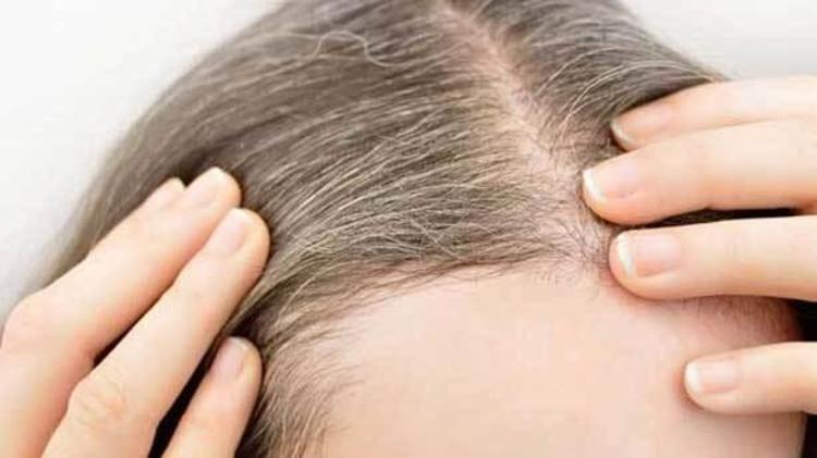 Saçlar neden beyazlar