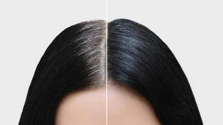 Tiroit rahatsızlıkları