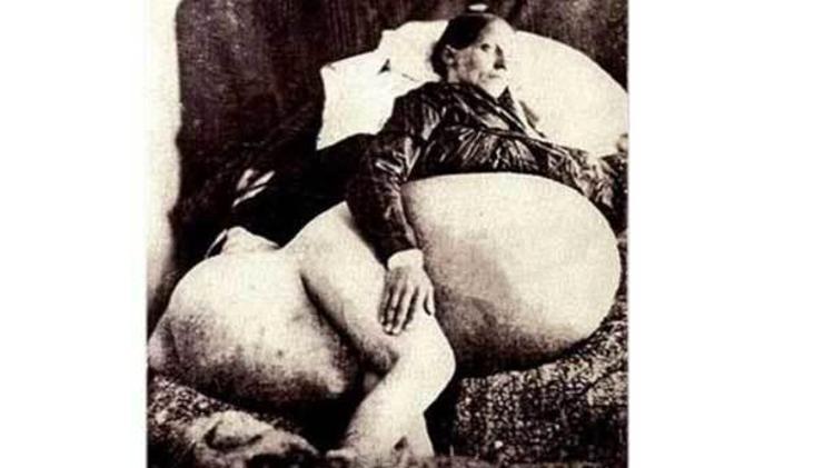 Tümörlörinden kurtulmak için at sırtında giden kadın