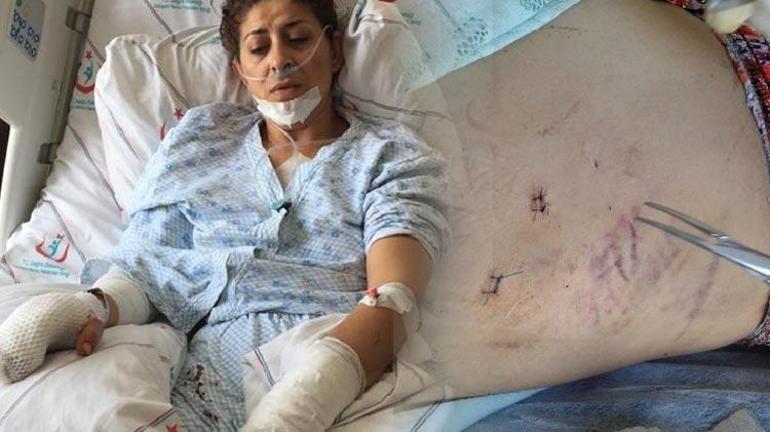 Eşi 15 yerinden bıçakladı Dinlerken acı çektim dedi